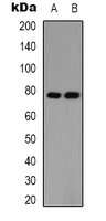 PIAS1 Antibody - Western blot analysis of PIAS1 expression in HUVEC (A); Jurkat (B) whole cell lysates.