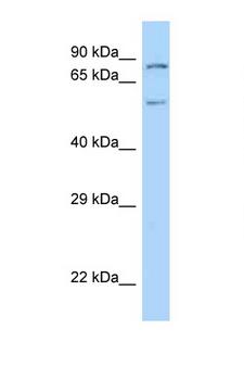 PIAS2 / PIASX Antibody - PIAS2 antibody Western blot of Mouse Heart lysate. Antibody concentration 1 ug/ml.  This image was taken for the unconjugated form of this product. Other forms have not been tested.