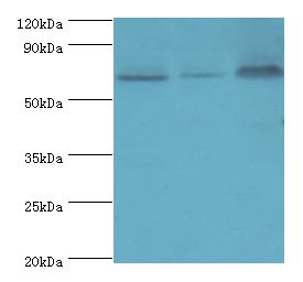 PIAS2 / PIASX Antibody - Western blot. All lanes: PIAS2 antibody at 2 ug/ml. Lane 1: A431 whole cell lysate. Lane 2: HepG2 whole cell lysate. Lane 3: mouse brain tissue. Secondary antibody: Goat polyclonal to rabbit at 1:10000 dilution. Predicted band size: 68 kDa. Observed band size: 68 kDa.