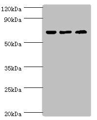 PIAS2 / PIASX Antibody - Western blot All lanes: PIAS2 antibody at 2µg/ml Lane 1: A431 whole cell lysate Lane 2: HepG2 whole cell lysate Lane 3: Mouse brain tissue Secondary Goat polyclonal to rabbit IgG at 1/10000 dilution Predicted band size: 69, 64, 46 kDa Observed band size: 69 kDa