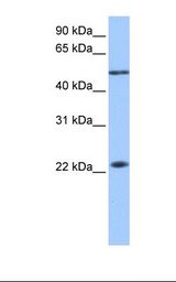 PIAS2 / PIASX Antibody - Fetal liver lysate. Antibody concentration: 1.0 ug/ml. Gel concentration: 12%.  This image was taken for the unconjugated form of this product. Other forms have not been tested.