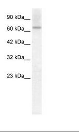PIAS2 / PIASX Antibody - HepG2 Cell Lysate.  This image was taken for the unconjugated form of this product. Other forms have not been tested.