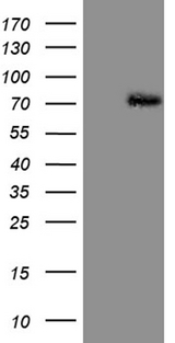 PIAS2 / PIASX Antibody - HEK293T cells were transfected with the pCMV6-ENTRY control. (Left lane) or pCMV6-ENTRY PIAS2. (Right lane) cDNA for 48 hrs and lysed. Equivalent amounts of cell lysates. (5 ug per lane) were separated by SDS-PAGE and immunoblotted with anti-PIAS2. (1:500)