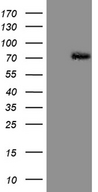 PIAS2 / PIASX Antibody - HEK293T cells were transfected with the pCMV6-ENTRY control. (Left lane) or pCMV6-ENTRY PIAS2. (Right lane) cDNA for 48 hrs and lysed