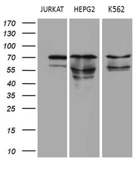 PIAS2 / PIASX Antibody - Western blot analysis of extracts. (35ug) from 3 different cell lines by using anti-PIAS2 monoclonal antibody. (Jurkat:human;Hepg2:human;K562:human). (1:500)
