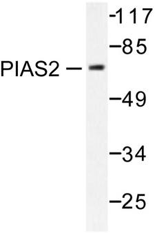 PIAS2 / PIASX Antibody - Western blot of PIAS2 (G24) pAb in extracts from COS7 cells.