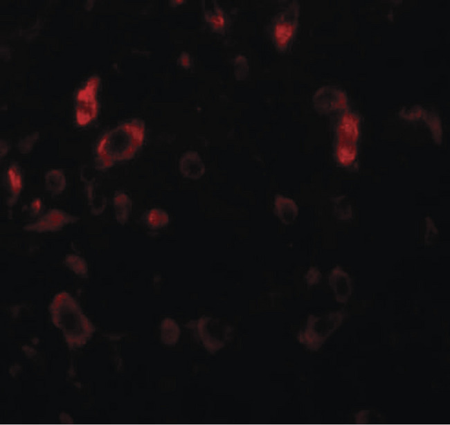 PIAS2 / PIASX Antibody - Immunofluorescence of PIAS2 in rat brain tissue with PIAS2 antibody at 20 ug/ml.
