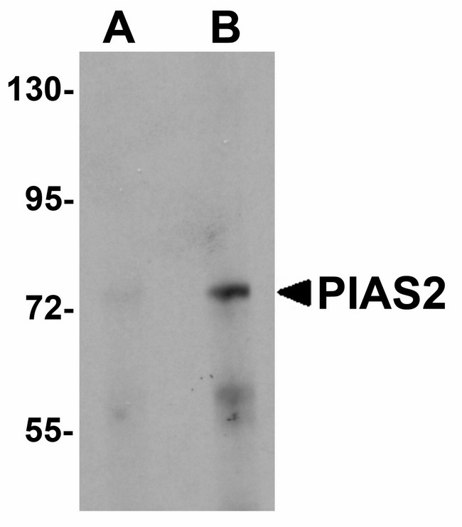 PIAS2 / PIASX Antibody - Western blot of PIAS2 in rat brain tissue lysate with PIAS2 antibody at (A) 1 and (B) 2 ug/ml.