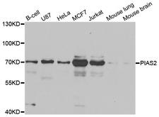 PIAS2 / PIASX Antibody - Western blot analysis of extracts of various cell lines.