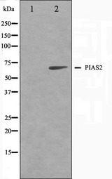 PIAS2 / PIASX Antibody - Western blot analysis on COS7 cell lysates using PIAS2 antibody. The lane on the left is treated with the antigen-specific peptide.