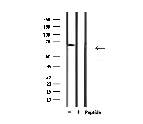 PIAS2 / PIASX Antibody - Western blot analysis of extracts of 293 cells and HeLa cells using PIAS2 antibody.