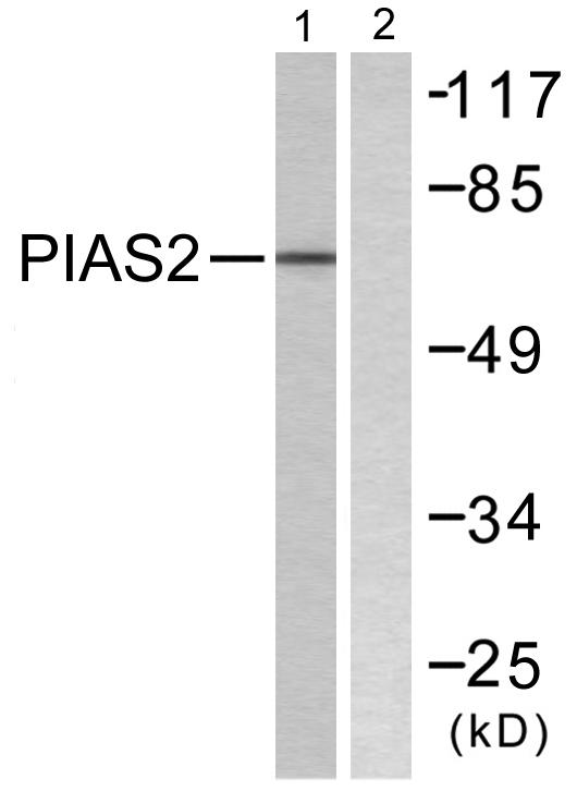 PIAS2 / PIASX Antibody - Western blot analysis of extracts from COS7 cells, using PIAS2 antibody.