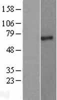 PIAS2 / PIASX Protein - Western validation with an anti-DDK antibody * L: Control HEK293 lysate R: Over-expression lysate