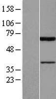 PIAS2 / PIASX Protein - Western validation with an anti-DDK antibody * L: Control HEK293 lysate R: Over-expression lysate