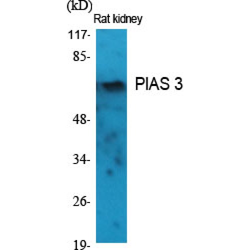 PIAS3 Antibody - Western blot of PIAS 3 antibody