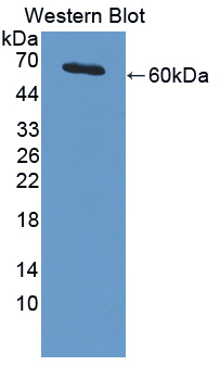 PIAS3 Antibody - Western blot of PIAS3 antibody.