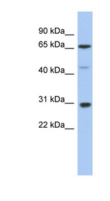 PIAS3 Antibody - PIAS3 antibody Western blot of Fetal Spleen lysate. This image was taken for the unconjugated form of this product. Other forms have not been tested.