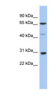 PIAS3 Antibody - PIAS3 antibody Western blot of Fetal Spleen lysate. This image was taken for the unconjugated form of this product. Other forms have not been tested.