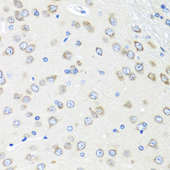 PIAS3 Antibody - Immunohistochemistry of paraffin-embedded rat brain tissue.