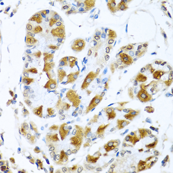 PIAS3 Antibody - Immunohistochemistry of paraffin-embedded human stomach tissue.