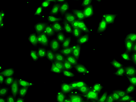 PIAS3 Antibody - Immunofluorescence analysis of U20S cells.