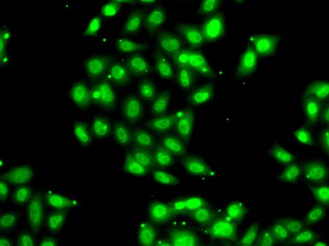 PIAS3 Antibody - Immunofluorescence analysis of U2OS cells using PIAS3 antibody.