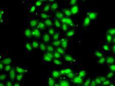 PIAS3 Antibody - Immunofluorescence analysis of U2OS cells using PIAS3 antibody.
