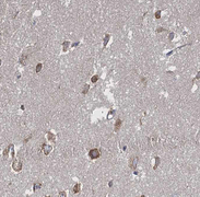 PIAS3 Antibody - 1:100 staining human brain tissue by IHC-P. The tissue was formaldehyde fixed and a heat mediated antigen retrieval step in citrate buffer was performed. The tissue was then blocked and incubated with the antibody for 1.5 hours at 22°C. An HRP conjugated goat anti-rabbit antibody was used as the secondary.