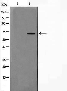 PIAS3 Antibody - Western blot analysis on 293 cell lysates using PIAS3 antibody. The lane on the left is treated with the antigen-specific peptide.