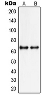 PIAS3 Antibody - Western blot analysis of PIAS3 expression in MCF7 (A); HepG2 (B) whole cell lysates.