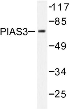 PIAS3 Antibody - Western blot of PIAS3 (F25) pAb in extracts from 293 cells treated with UV 5'.