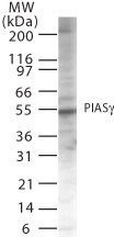 PIAS4 / PIASY Antibody - Western blot of PIASg in Jurkat cell lysate using antibody at 2 ug/ml.