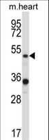 PIAS4 / PIASY Antibody - PIAS4 Antibody western blot of mouse heart tissue lysates (35 ug/lane). The PIAS4 antibody detected the PIAS4 protein (arrow).