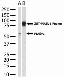 PIAS4 / PIASY Antibody - The anti-PIASy polyclonal antibody is used in Western blot to detect PIASy in HL-60 cell lysate.