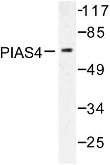 PIAS4 / PIASY Antibody - Western blot of PIAS4 (D488) pAb in extracts from Jurkat cells.