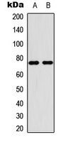 PIAS4 / PIASY Antibody - Western blot analysis of PIAS4 expression in HepG2 (A); HeLa (B) whole cell lysates.