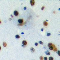 PIAS4 / PIASY Antibody - Immunohistochemical analysis of PIAS4 staining in human brain formalin fixed paraffin embedded tissue section. The section was pre-treated using heat mediated antigen retrieval with sodium citrate buffer (pH 6.0). The section was then incubated with the antibody at room temperature and detected using an HRP conjugated compact polymer system. DAB was used as the chromogen. The section was then counterstained with hematoxylin and mounted with DPX.