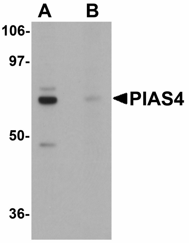 PIAS4 / PIASY Antibody - Western blot of PIAS4 in rat brain tissue lysate with PIAS4 antibody at 1 ug/ml in (A) the absence and (B) the presence of blocking peptide.
