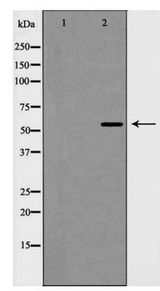 PIAS4 / PIASY Antibody - Western blot of PIAS4 expression in Jurkat cell extract