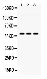 PIAS4 / PIASY Antibody - Western blot analysis of PIAS4 expression in rat testis extract, mouse testis extract and HELA whole cell lysates. PIAS4 at 57KD was detected using rabbit anti-PIAS4 Antigen Affinity purified polyclonal antibody at 0.5 ug/ml. The blot was developed using chemiluminescence (ECL) method.