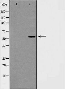PIAS4 / PIASY Antibody - Western blot analysis of PIAS4 expression in Jurkat cells extract. The lane on the left is treated with the antigen-specific peptide.