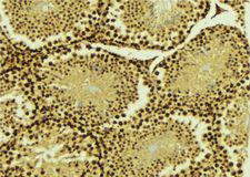 PIAS4 / PIASY Antibody - 1:100 staining mouse testis tissue by IHC-P. The sample was formaldehyde fixed and a heat mediated antigen retrieval step in citrate buffer was performed. The sample was then blocked and incubated with the antibody for 1.5 hours at 22°C. An HRP conjugated goat anti-rabbit antibody was used as the secondary.