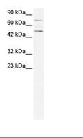 PIAS4 / PIASY Antibody - Jurkat Cell Lysate.  This image was taken for the unconjugated form of this product. Other forms have not been tested.