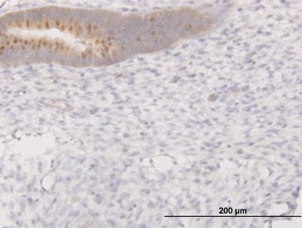 PIBF1 / PIBF Antibody - Immunoperoxidase of monoclonal antibody to C13orf24 on formalin-fixed paraffin-embedded human endometrium. [antibody concentration 1 ug/ml]