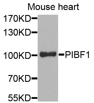 PIBF1 / PIBF Antibody - Western blot analysis of extracts of mouse heart cells.