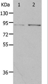 PIBF1 / PIBF Antibody - Western blot analysis of HeLa and 293T cell, using PIBF1 Polyclonal Antibody at dilution of 1:400.