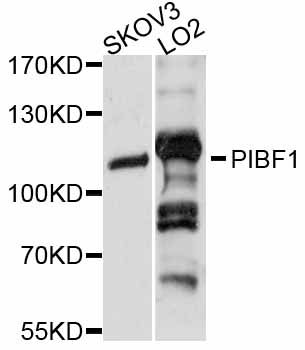 PIBF1 / PIBF Antibody - Western blot analysis of extracts of various cell lines, using PIBF1 antibody at 1:3000 dilution. The secondary antibody used was an HRP Goat Anti-Rabbit IgG (H+L) at 1:10000 dilution. Lysates were loaded 25ug per lane and 3% nonfat dry milk in TBST was used for blocking. An ECL Kit was used for detection and the exposure time was 3s.