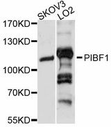 PIBF1 / PIBF Antibody - Western blot analysis of extracts of various cell lines, using PIBF1 antibody at 1:3000 dilution. The secondary antibody used was an HRP Goat Anti-Rabbit IgG (H+L) at 1:10000 dilution. Lysates were loaded 25ug per lane and 3% nonfat dry milk in TBST was used for blocking. An ECL Kit was used for detection and the exposure time was 3s.