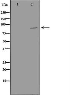 PIBF1 / PIBF Antibody - Western blot analysis of LOVO cells cell lysates using PIBF1 antibody. The lane on the left is treated with the antigen-specific peptide.