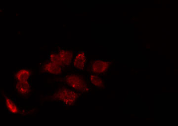 PIBF1 / PIBF Antibody - Staining LOVO cells by IF/ICC. The samples were fixed with PFA and permeabilized in 0.1% Triton X-100, then blocked in 10% serum for 45 min at 25°C. The primary antibody was diluted at 1:200 and incubated with the sample for 1 hour at 37°C. An Alexa Fluor 594 conjugated goat anti-rabbit IgG (H+L) Ab, diluted at 1/600, was used as the secondary antibody.